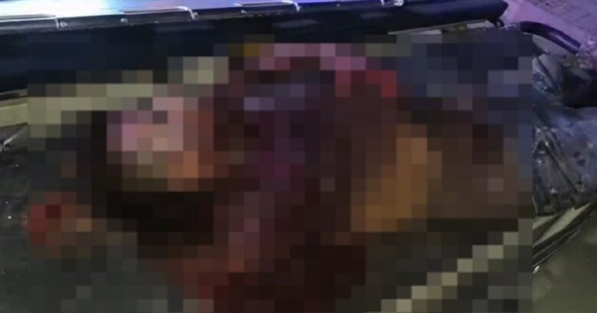 रेलवे स्टेशन पर दर्दनाक हादसा, ट्रेन की चपेट में आने से युवक का हाथ कटा…मची अफरा-तफरी, गंभीर हालत में अस्पताल में भर्ती