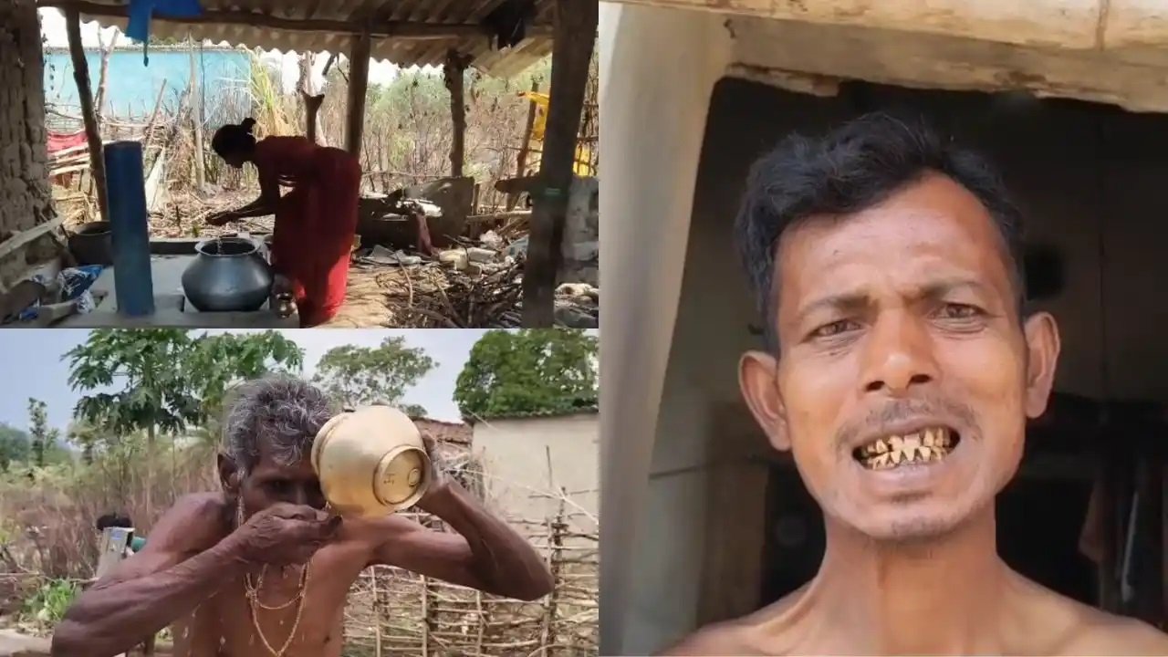 कोरबा में फ्लोराइड का कहर, 237 लोग फ्लोरोसिस की चपेट में, गांवों में बढ़ा संकट