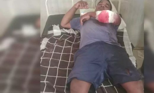 जंगल में फुटू लेने गए ग्रामीणों पर भालुओं का हमला, तीन घायल; दो की हालत गंभीर