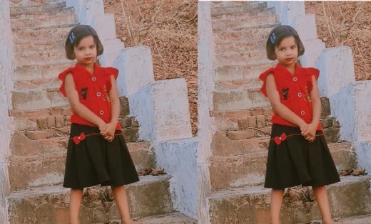 बिलासपुर में सर्पदंश से दो बच्चों की मौत, एक हफ्ते में दूसरी घटना; सिम्स में दो महीने में पहुंचे 47 मरीज